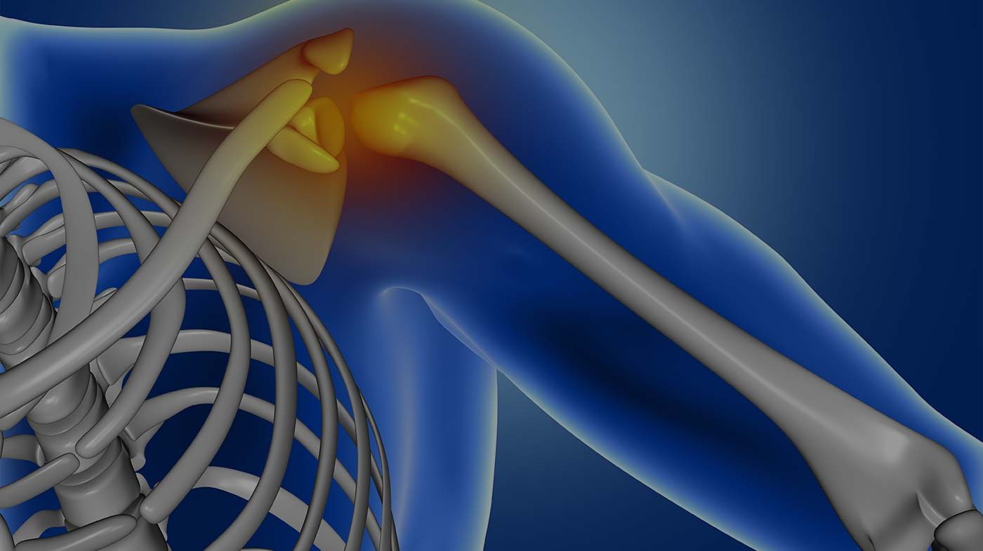 Shoulder Pain Specialist - Lake Pointe Orthopaedics | Orthopedic ...