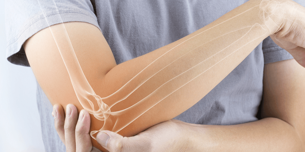 Man with elbow pain